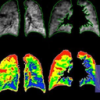 Polarean Imaging